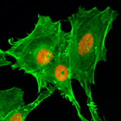 Immunocytochemical staining of HeLa cells treated with sodium butyrate, using anti-Acetyl-Histone H4 (Lys20) Rabbit Monoclonal Antibody (clone RM205) (red). Actin filaments have been labeled with fluorescein phalloidin (green).