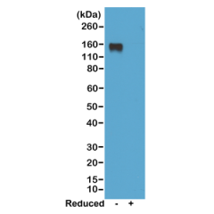 Western blot of nonreduced(-) and reduced(+) mouse IgG2a, using 0.5ug/mL of RevMAb clone RM219. This antibody reacts to nonreduced IgG2a (~150 kDa).