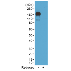 Western blot of nonreduced(-) and reduced(+) mouse IgA, using 0.5ug/mL of RevMAb clone RM220. This antibody reacts to nonreduced IgA.