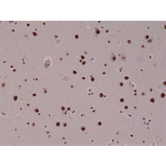 Immunohistochemical staining of formalin fixed and paraffin embedded human brain tissue sections, using rabbit monoclonal anti-5-hmC (clone RM236) antibody.