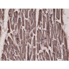 Immunohistochemical staining of formalin fixed and paraffin embedded human heart tissue sections using Anti-Acetyl CoA Carboxylase 1 RM232 at a 1:300 dilution.