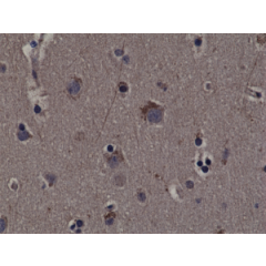 Immunohistochemical staining of formalin fixed and paraffin embedded human cerebral cortex tissue sections using Anti-phospho-Rsk1 (Thr359/Ser363) RM233 at a 1:200 dilution.