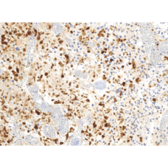 anti-Histone H3.3 G34R  Mutant (human), Rabbit Monoclonal (RM240) (Biotin)