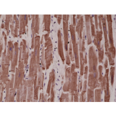 Immunohistochemical staining of formalin fixed and paraffin embedded human heart tissue sections using Anti-Desmin RM234 at a 1:4000 dilution.