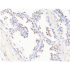 anti-AR (C-terminal) (human), Rabbit Monoclonal (RM255)