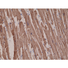 Immunohistochemical staining of formalin fixed and paraffin embedded human heart tissue sections using Anti-alpha-cardiac actin rabbit monoclonal antibody, Clone RM257 at a 1:1000 dilution.