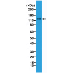 Western Blot analysis of HeLa whole cell lysates, using anti-N-cadherin rabbit monoclonal antibody (Clone RM259), showed N-cadherin expression in HeLa cells.