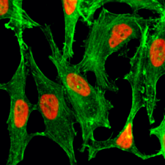 Immunocytochemistry of HeLa cells treated with sodium butyrate, using Acetyl-Histone H2B (Lys23) rabbit monoclonal antibody (RM260) (red). Actin filaments have been labeled with fluorescein phalloidin (green).