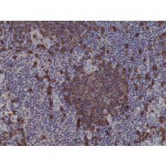 Immunohistochemical staining of formalin fixed and paraffin embedded human tonsil tissue sections using Anti-CD20 Rabbit Monoclonal Antibody (Clone RM272) at a 1:1000 dilution.