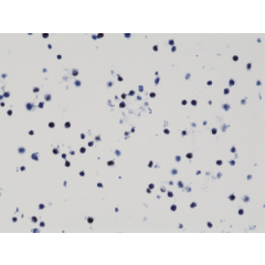 anti-Histone H3 K9M (human), Rabbit Monoclonal (RM191)