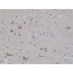 Immunohistochemical staining of formalin fixed and paraffin embedded human brain tissue sections using Anti-Neurofilament-L (NF-L) Rabbit Monoclonal Antibody (Clone RM280) at a 1:2500 dilution.