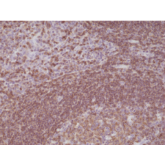 Immunohistochemical staining of formalin fixed and paraffin embedded human tonsil tissue sections using Anti-CD45 Rabbit Monoclonal Antibody (Clone RM291) at a 1:200 dilution.