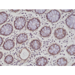 Immunohistochemical staining of formalin fixed and paraffin embedded human colon tissue sections using anti-CD29 rabbit monoclonal antibody (clone RM285) at a 1:200 dilution.