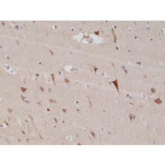 Immunohistochemical staining of formalin fixed and paraffin embedded human brain tissue sections using Anti-PSD95 Rabbit Monoclonal Antibody (Clone RM288) at a 1:200 dilution.