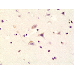 Immunohistochemical staining of formalin fixed and paraffin embedded human brain tissue sections using Anti-Phospho-AMPA Receptor (GluR 1) (Ser845) rabbit monoclonal antibody (clone RM296) at a 1:200 dilution.