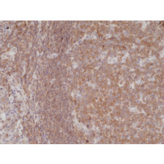 Immunohistochemical staining of formalin fixed and paraffin embedded human tonsil tissue section using anti-NF-kappa-B p105/p50 rabbit monoclonal antibody (clone RM299) at a 1:200 dilution.