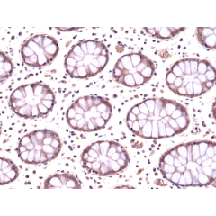 Immunohistochemical staining of formalin fixed and paraffin embedded human colon tissue section using anti-AMPK alpha-1 rabbit monoclonal antibody (clone RM301) at a 1:200 dilution.