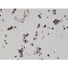 Immunohistochemistry staining of naïve HepG2 cells (Negative control) using anti-His-Tag antibody, RM146.