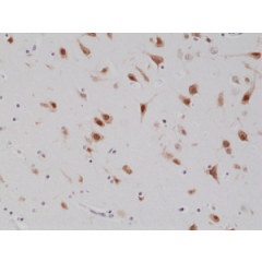 Immunohistochemical staining of formalin fixed and paraffin embedded human brain tissue section using anti-NeuN rabbit monoclonal antibody (Clone RM312) at a 1:1000 dilution.