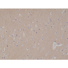 Immunohistochemical staining of formalin fixed and paraffin embedded human brain tissue section using anti-CD56 rabbit monoclonal antibody (Clone RM315) at a 1:1000 dilution.