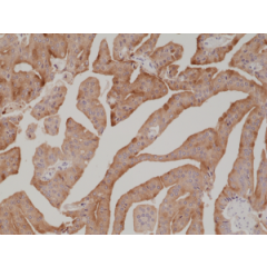 anti-PSA (human), Rabbit Monoclonal (RM323) (Biotin)