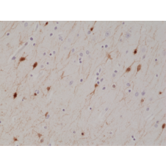 Immunohistochemical staining of formalin fixed and paraffin embedded human brain tissue section using anti-Calretinin rabbit monoclonal antibody (Clone RM324) at a 1:1000 dilution.