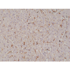 Immunohistochemical staining of formalin fixed and paraffin embedded human liver tissue section using anti-Caveolin-1 rabbit monoclonal antibody (Clone RM325) at a 1:1000 dilution.