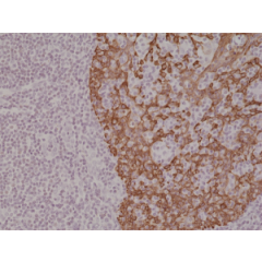 Immunohistochemical staining of formalin fixed and paraffin embedded human tonsil tissue section using anti-CK-14 rabbit monoclonal antibody (Clone RM328) at a 1:2000 dilution.