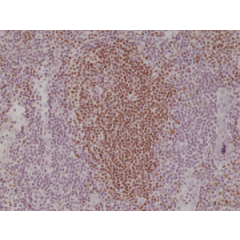 Immunohistochemical staining of formalin fixed and paraffin embedded human tonsil tissue section using anti-Paired box protein Pax-5 rabbit monoclonal antibody (Clone RM331) at a 1:1000 dilution.