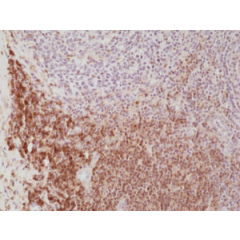 Immunohistochemical staining of formalin fixed and paraffin embedded human Tonsil tissue section using anti-CD4 rabbit monoclonal antibody (CloneRM345) at a 1:500 dilution.