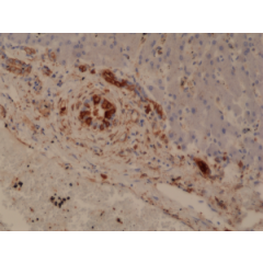 Immunohistochemical staining of formalin fixed and paraffin embedded human Liver tissue section using anti-GSTP1 rabbit monoclonal antibody (Clone RM347) at a 1:20000 dilution.