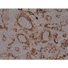 Immunohistochemical staining of formalin fixed and paraffin embedded human tonsil tissue section using anti-CK-17 rabbit monoclonal antibody (Clone RM351) at a 1:1000 dilution.