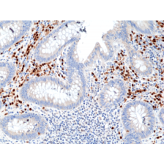 Immunohistochemical staining of formalin fixed and paraffin embedded human Appendix tissue section using anti-MUM1/IRF4 rabbit monoclonal antibody (Clone RM352) at a 1:800 dilution.