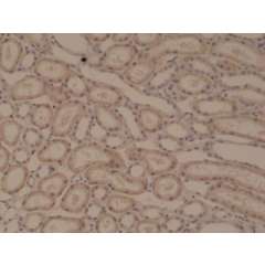 Immunohistochemical staining of formalin fixed and paraffin embedded human kidney tissue section using anti-p120 catenin rabbit monoclonal antibody (Clone RM353) at a 1:5000 dilution.