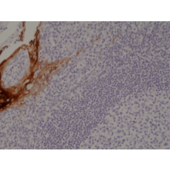 Immunohistochemical staining of formalin fixed and paraffin embedded human tonsil tissue section using anti-CK-4 rabbit monoclonal antibody (Clone RM355) at a 1:1000 dilution.