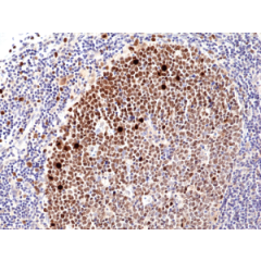 Immunohistochemical staining of formalin fixed and paraffin embedded human tonsil tissue sections, using anti-Ki-67 Rabbit Monoclonal Antibody (Clone RM360) at a 1:1000 dilution.