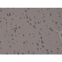 Immunohistochemical staining of formalin fixed and paraffin embedded human brain tissue section using anti-ALK rabbit monoclonal antibody (Clone RM361) at a 1:1000 dilution.