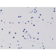 Immunohistochemical staining of formalin fixed and paraffin embedded 293T cells transfected with a DNA construct encoding wild type (WT) proteins of Histone H3, stained with anti-Histone H3 K4M rabbit monoclonal antibody clone RM363.