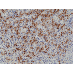 Immunohistochemical staining of formalin fixed and paraffin embedded human spleen tissue section using anti-CD163 rabbit monoclonal antibody (Clone RM371) at a 1:1000 dilution.