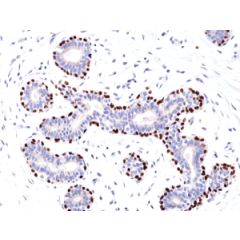 Immunohistochemical staining of formalin fixed and paraffin embedded human Breast tissue section using anti-p63 rabbit monoclonal antibody (Clone RM383) at a 1:100 dilution.