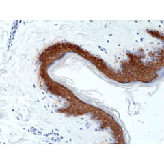 Immunohistochemical staining of formalin fixed and paraffin embedded human skin tissue section using anti-CK-10 rabbit monoclonal antibody (Clone RM386) at a 1:1000 dilution.