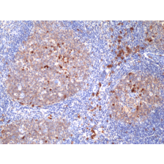 Immunohistochemical staining of formalin fixed and paraffin embedded human tonsil tissue section using anti-CD38 rabbit monoclonal antibody (Clone RM388) at a 1:100 dilution.