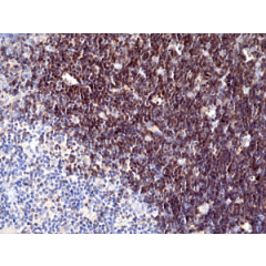 Immunohistochemical staining of formalin fixed and paraffin embedded human thymus tissue section using anti-CD1a rabbit monoclonal antibody (Clone RM393) at a 1:100 dilution.