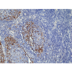 Immunohistochemical staining of formalin fixed and paraffin embedded human tonsil tissue section using anti-TOP2A rabbit monoclonal antibody (Clone RM 394) at a 1:100 dilution.