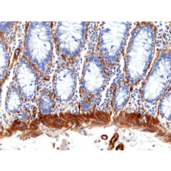 Immunohistochemical staining of formalin fixed and paraffin embedded human colon tissue section using anti-CALD1 rabbit monoclonal antibody (Clone RM396) at a 1:100 dilution.