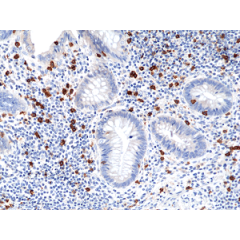 Immunohistochemical staining of formalin fixed and paraffin embedded human appendix tissue section using anti-CD8a rabbit monoclonal antibody (Clone RM397) at a 1:100 dilution.