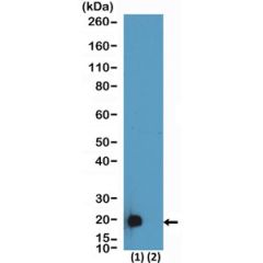 anti-DDDDK tag, Rabbit Monoclonal (RM399)