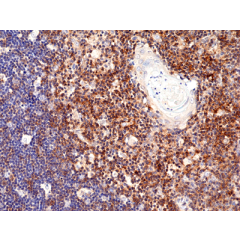 Immunohistochemical staining of formalin fixed and paraffin embedded human liver section using Anti-CD13 Rabbit Monoclonal Antibody (Clone RM403) at a 1:200 dilution.