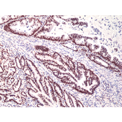 Immunohistochemical staining of formalin fixed and paraffin embedded human thymus using Anti-CD28 Rabbit Monoclonal Antibody (Clone RM404) at a 1:200 dilution.