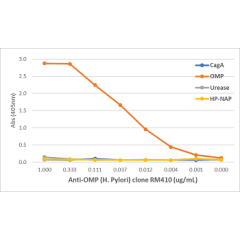 Immunohistochemical staining of formalin fixed and paraffin embedded human Hodgkin lymphoma tissue section using anti-CD25 rabbit monoclonal antibody (Clone RM418) at a 1:200 dilution.